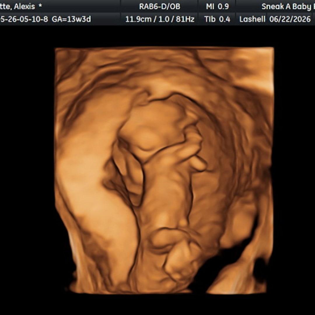 Photo shared by Alexis for their Babylist baby registry.
