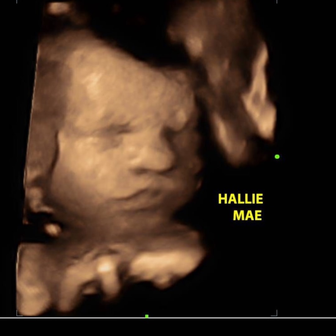 Photo shared by Lexi for their Babylist baby registry.