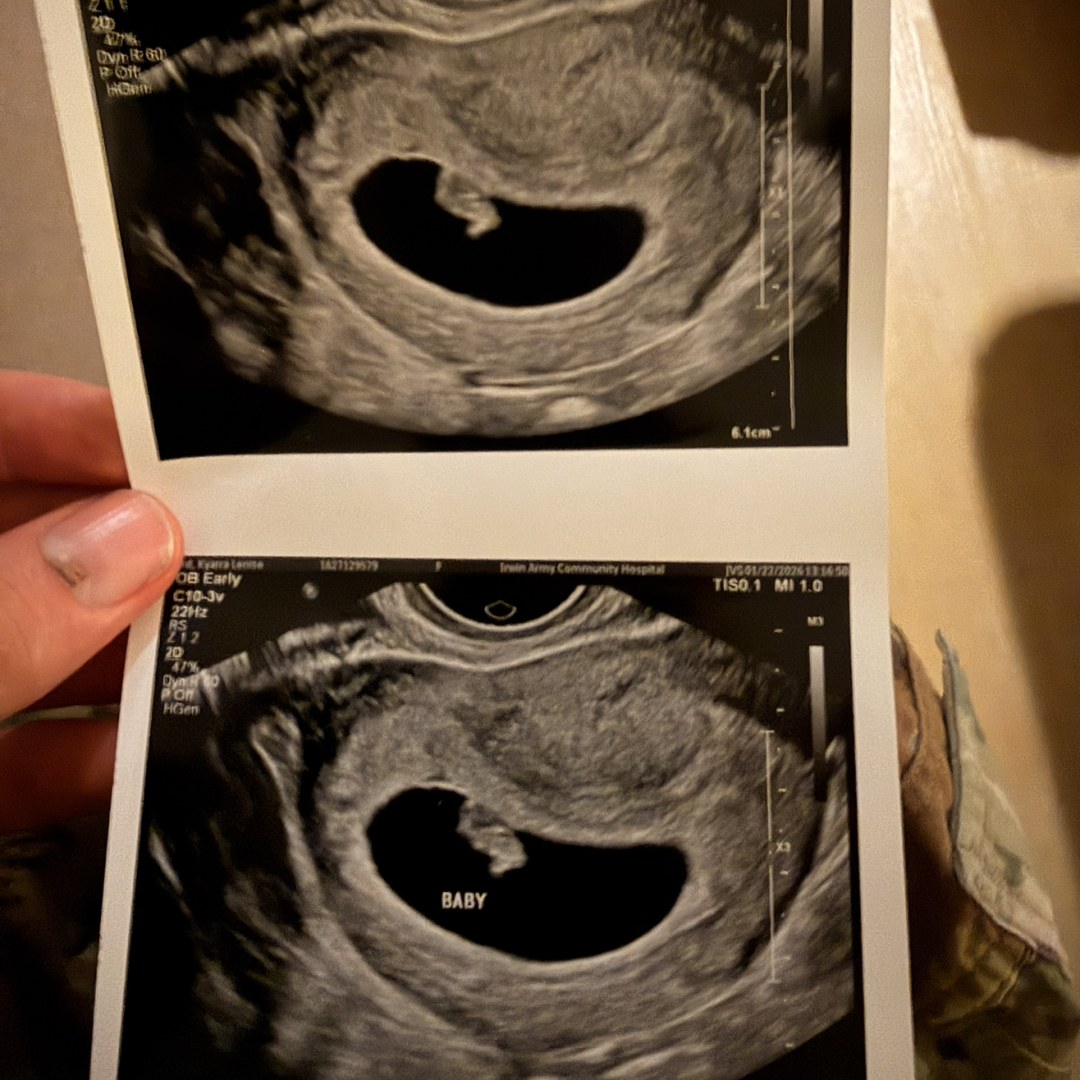 Photo shared by Christian for their Babylist baby registry.