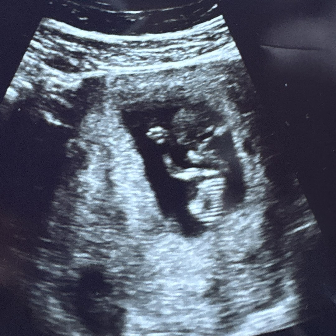 Photo shared by Maddie for their Babylist baby registry.