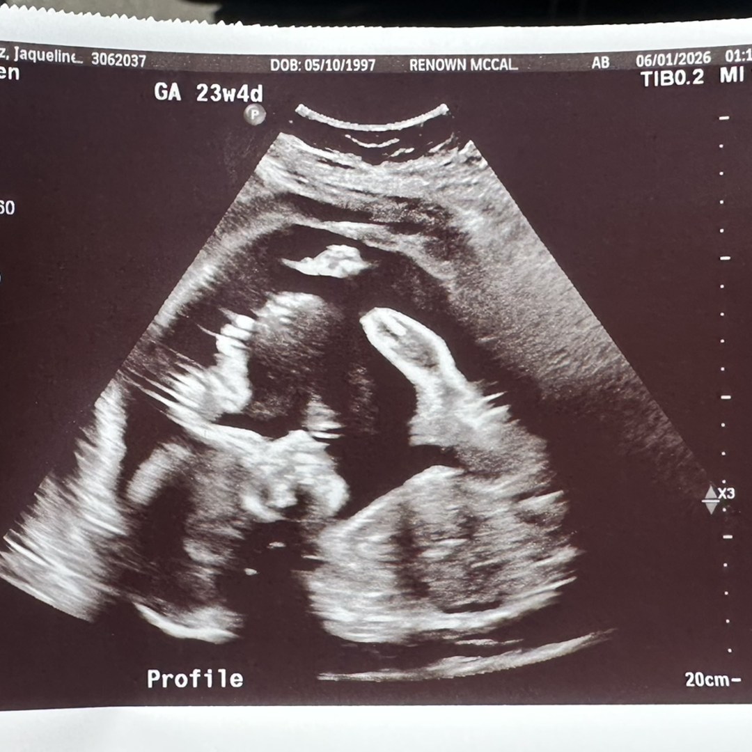 Photo shared by Jaqueline for their Babylist baby registry.