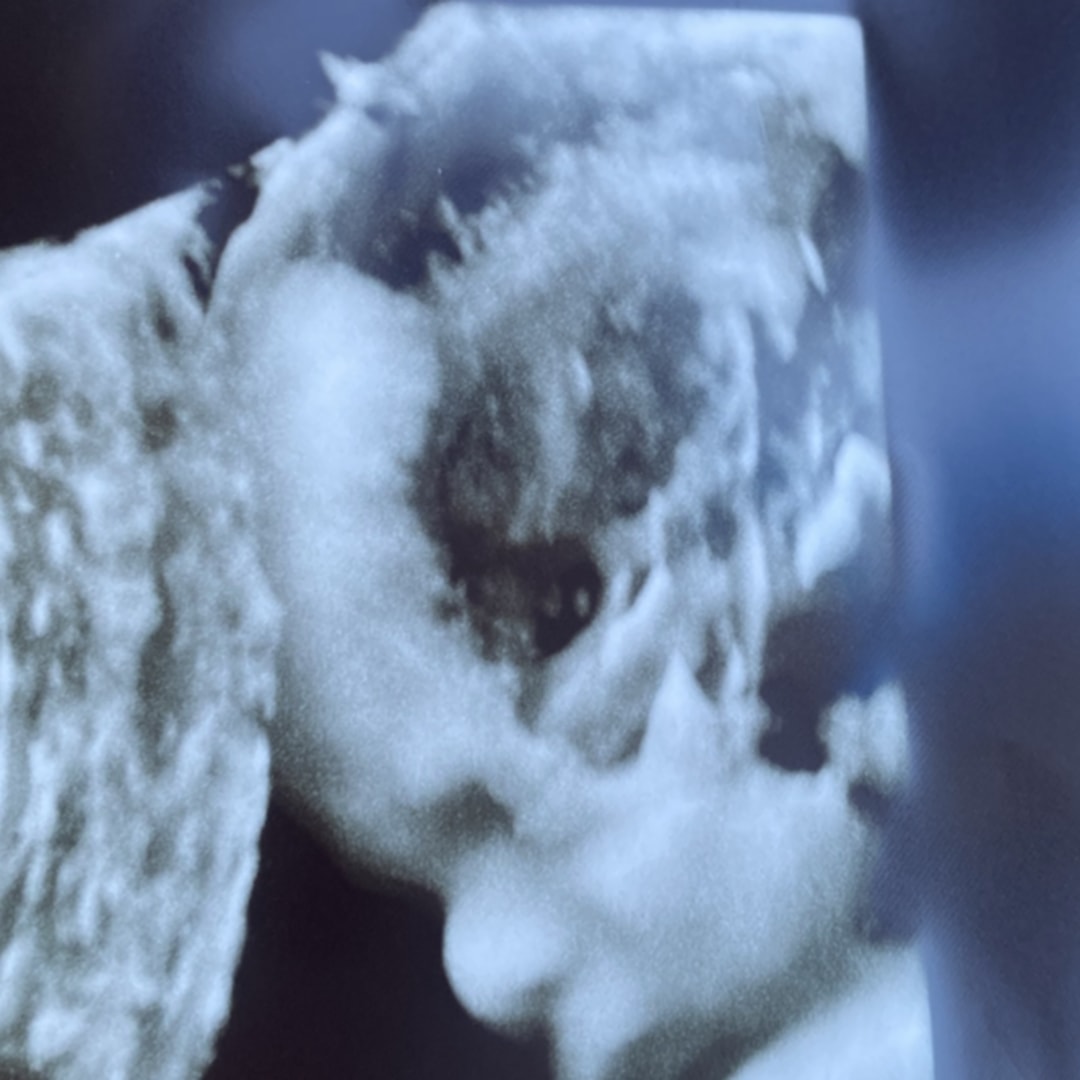 Photo shared by Alexandra for their Babylist baby registry.