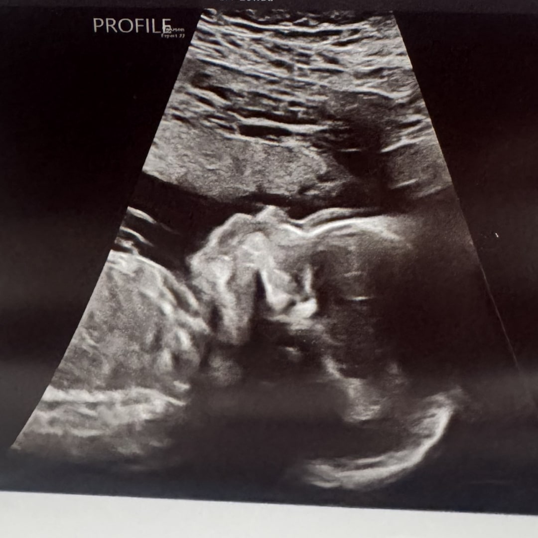 Photo shared by Courtney for their Babylist baby registry.