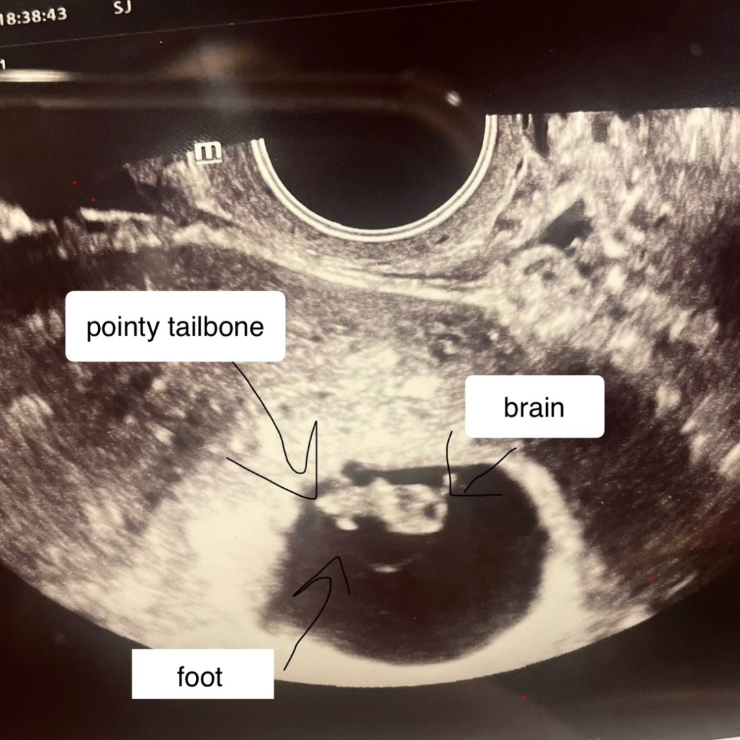 Photo shared by Chelsea for their Babylist baby registry.