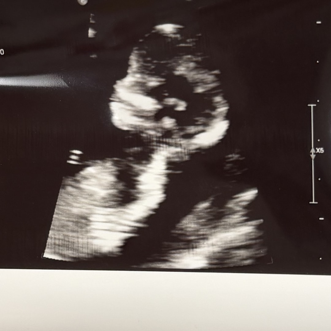 Photo shared by Christine for their Babylist baby registry.