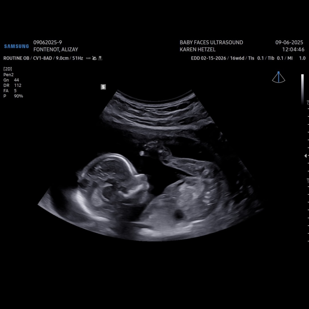 Photo shared by Alizay for their Babylist baby registry.