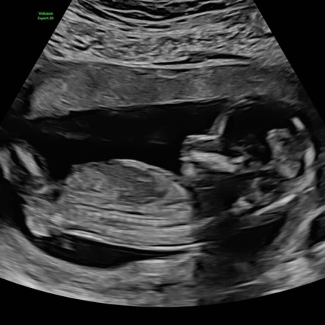 Photo shared by Ashley for their Babylist baby registry.