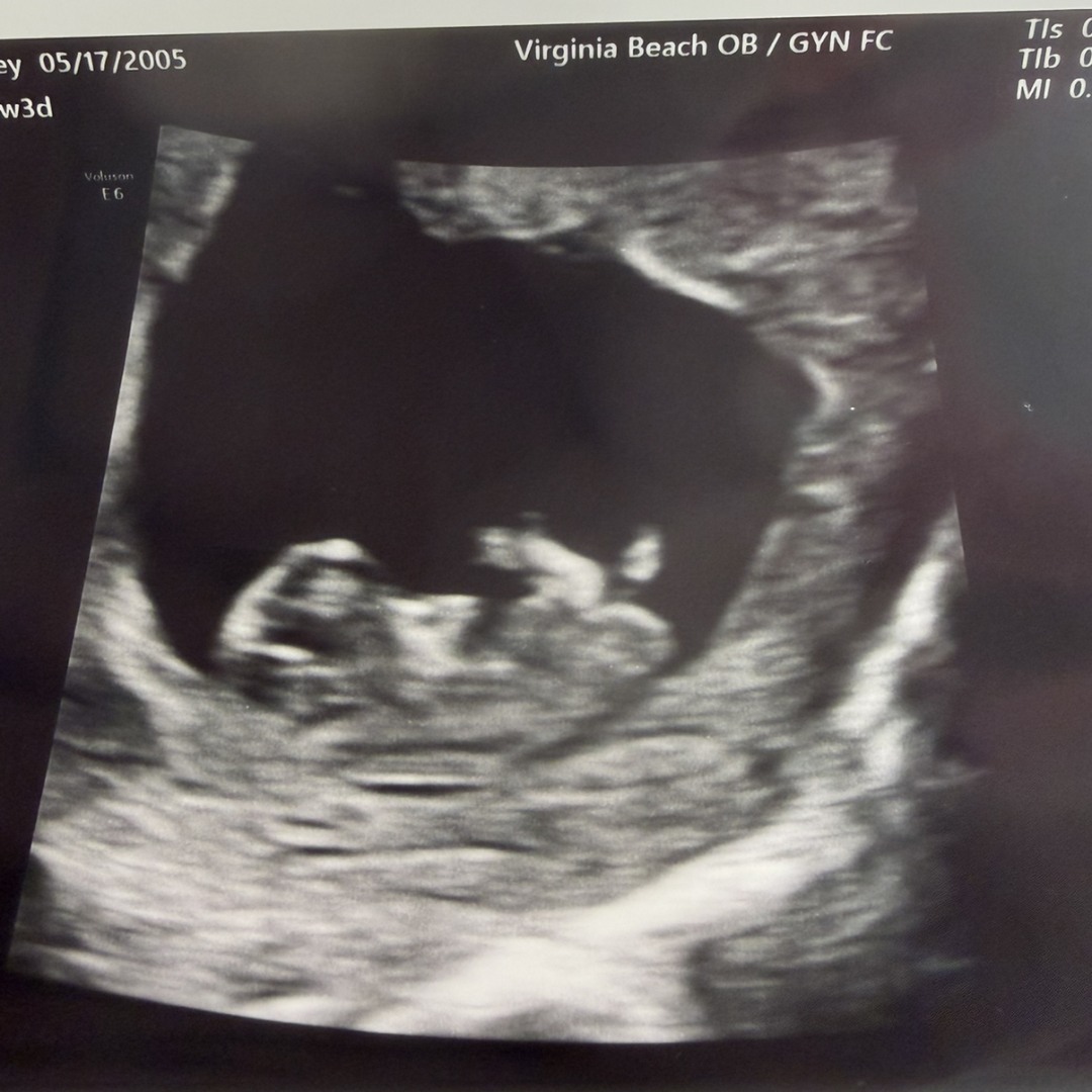 Photo shared by Casey for their Babylist baby registry.