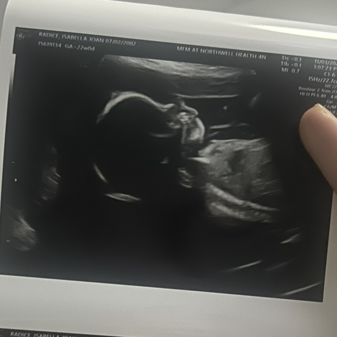 Photo shared by Isabella for their Babylist baby registry.