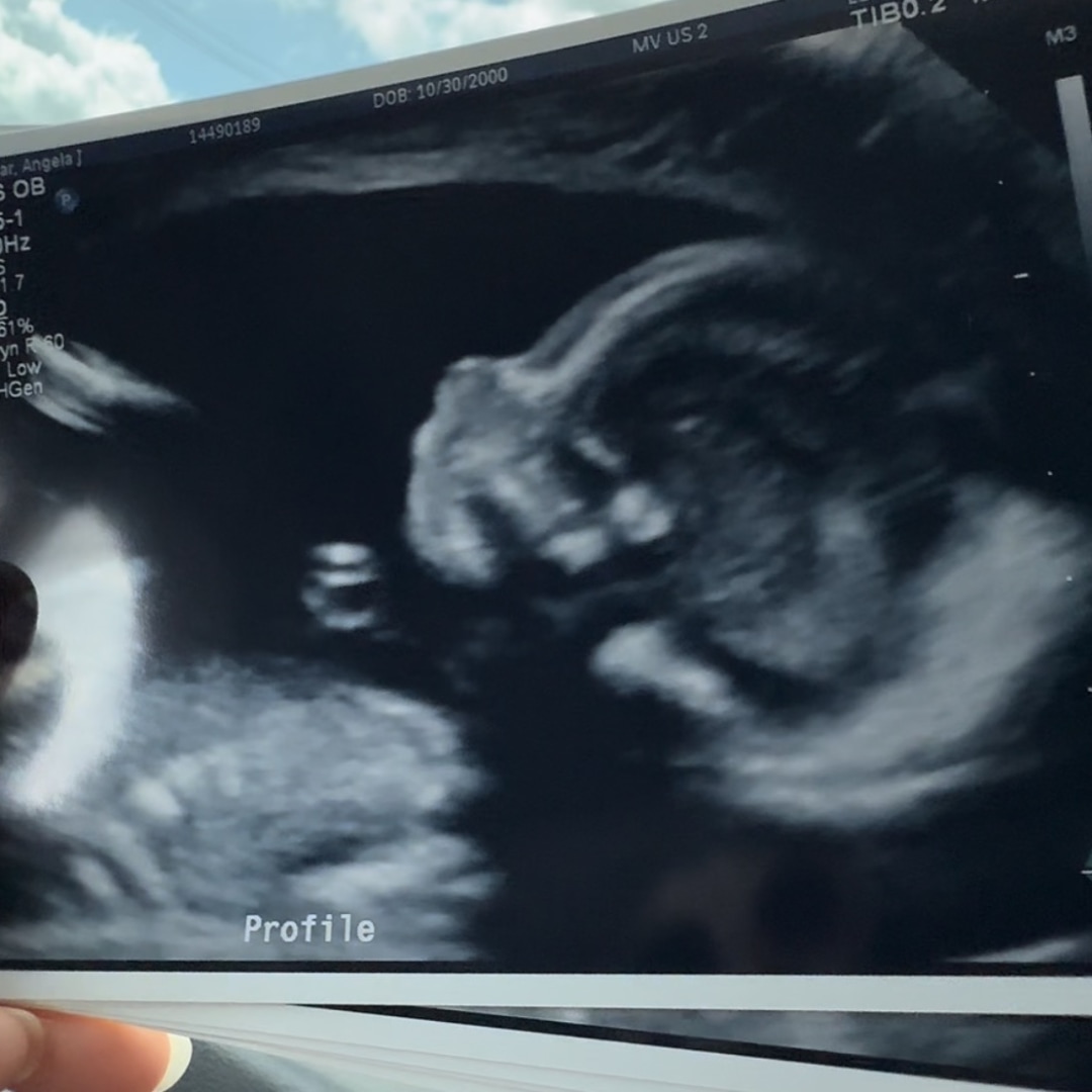 Photo shared by Angela for their Babylist baby registry.