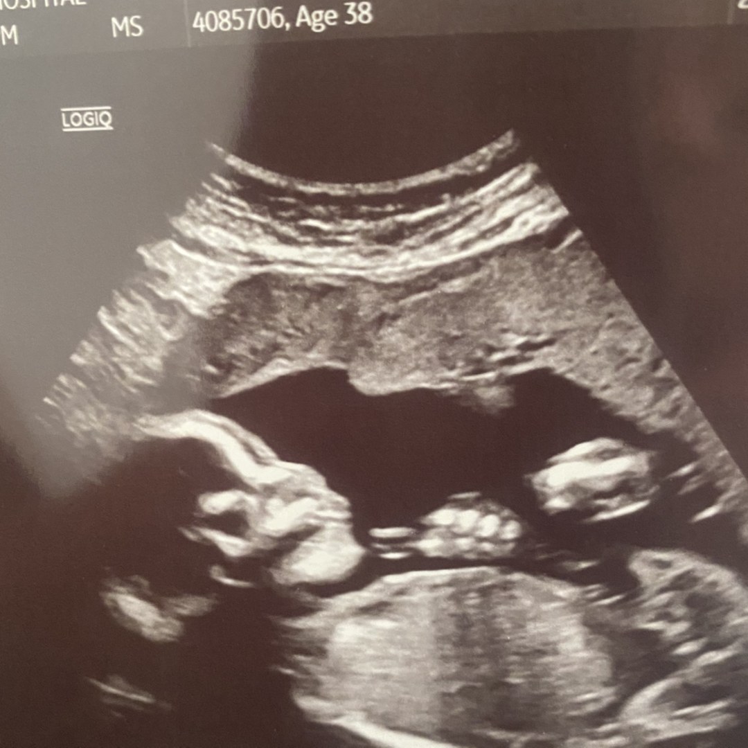 Photo shared by Lauren for their Babylist baby registry.