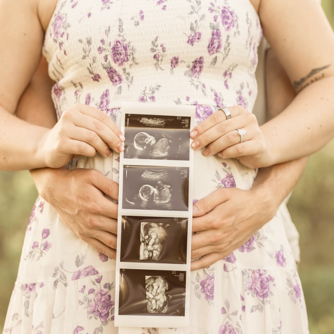 Photo shared by Megan for their Babylist baby registry.