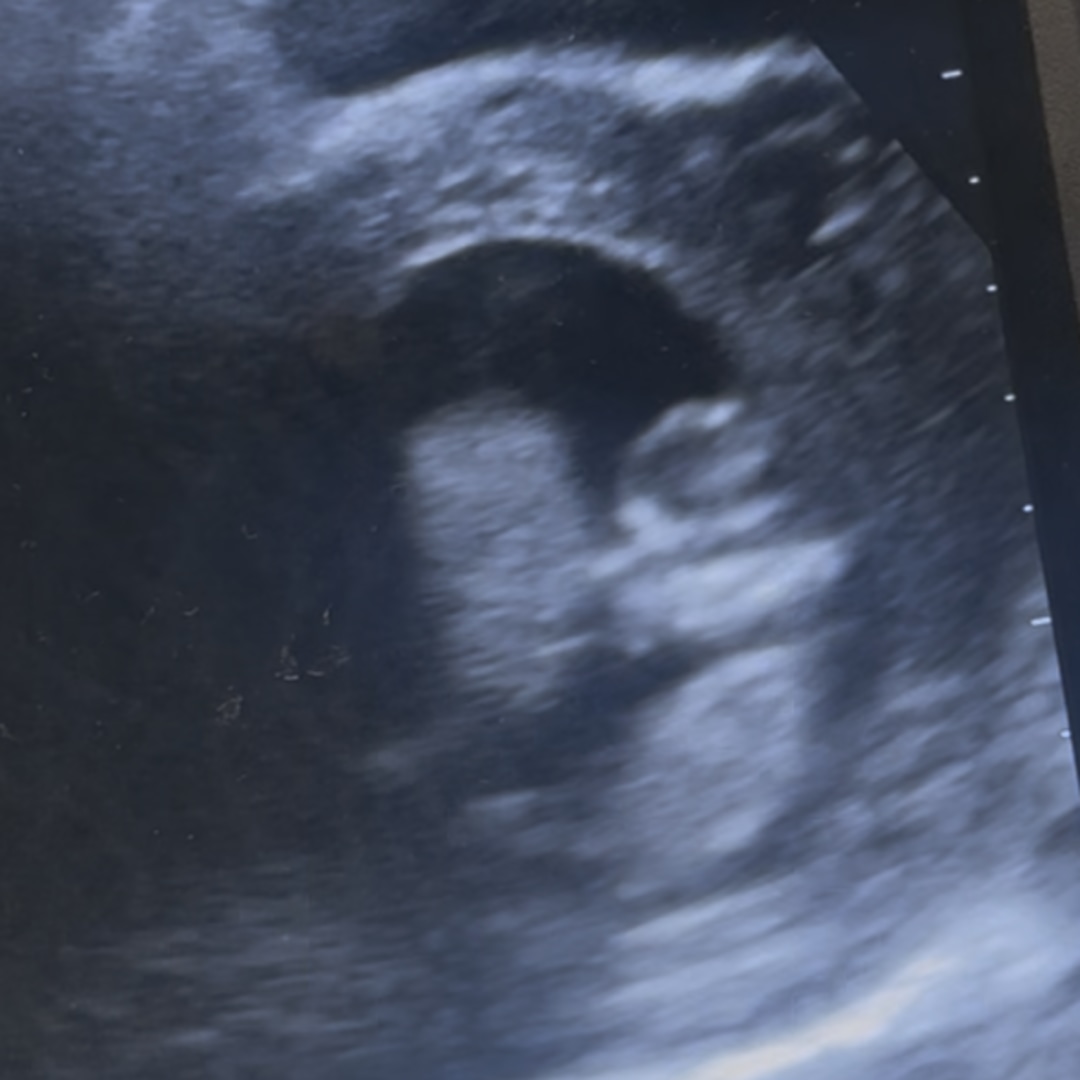 Photo shared by Alexis for their Babylist baby registry.