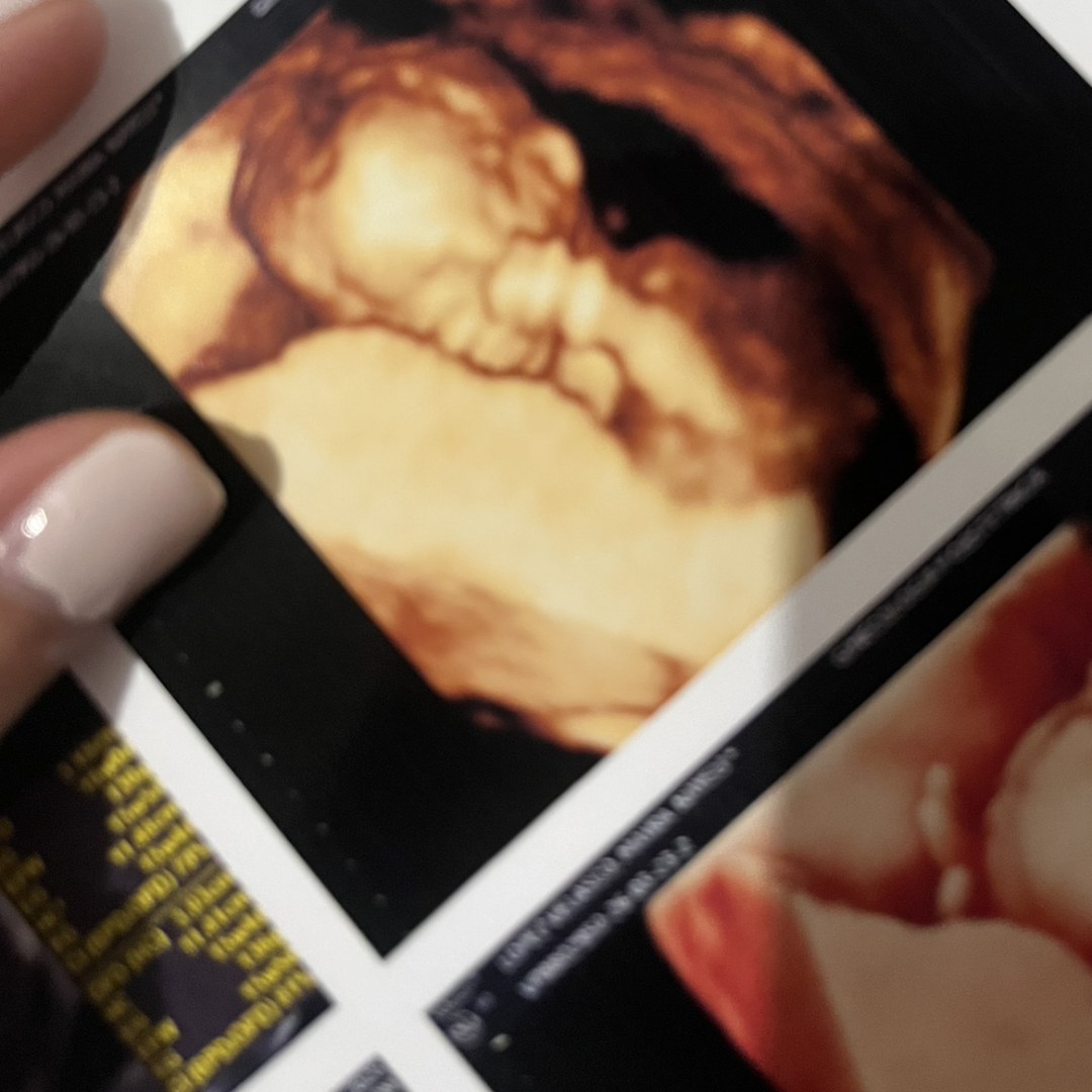 Photo shared by Mayra for their Babylist baby registry.