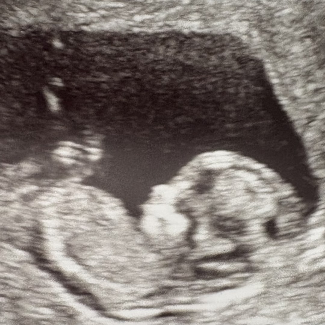 Photo shared by Angelic for their Babylist baby registry.
