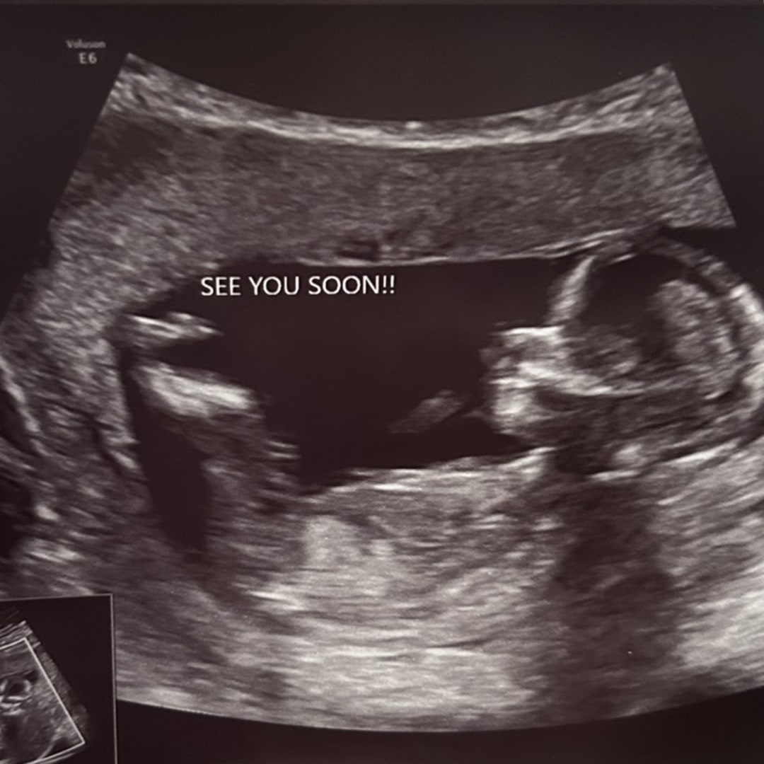 Photo shared by Jacklynn & Michael for their Babylist baby registry.