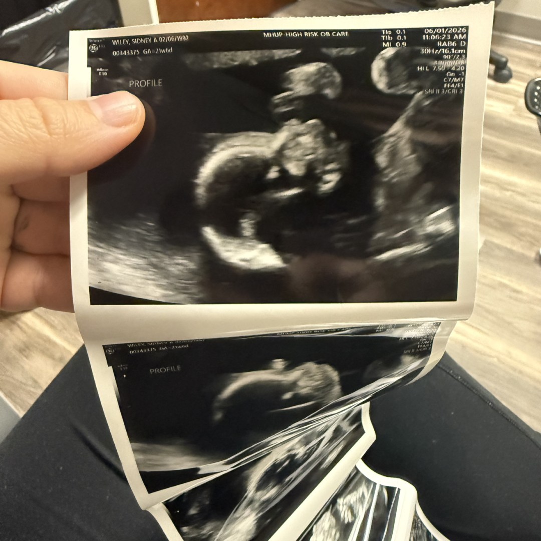 Photo shared by Sidney for their Babylist baby registry.