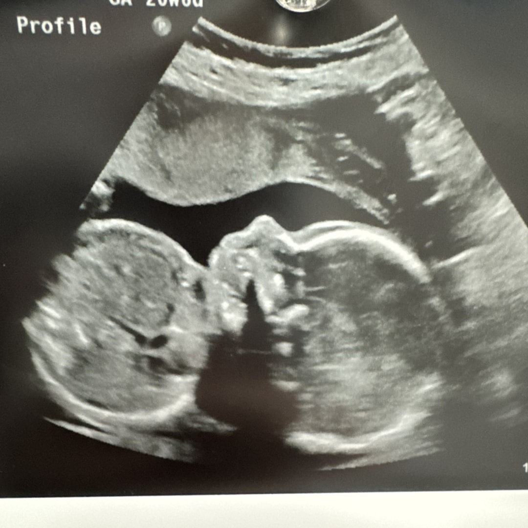 Photo shared by Haley for their Babylist baby registry.