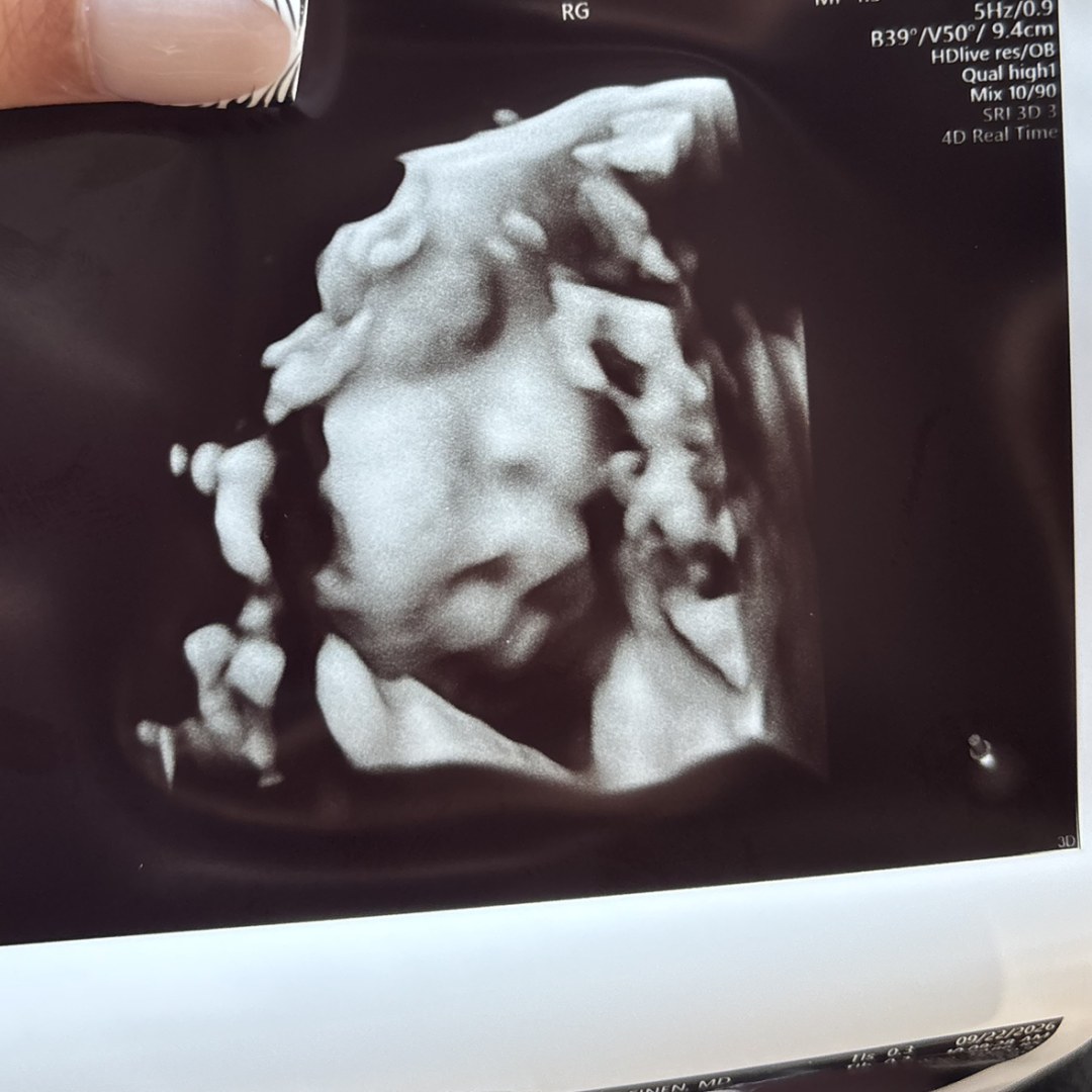 Photo shared by Hillary for their Babylist baby registry.