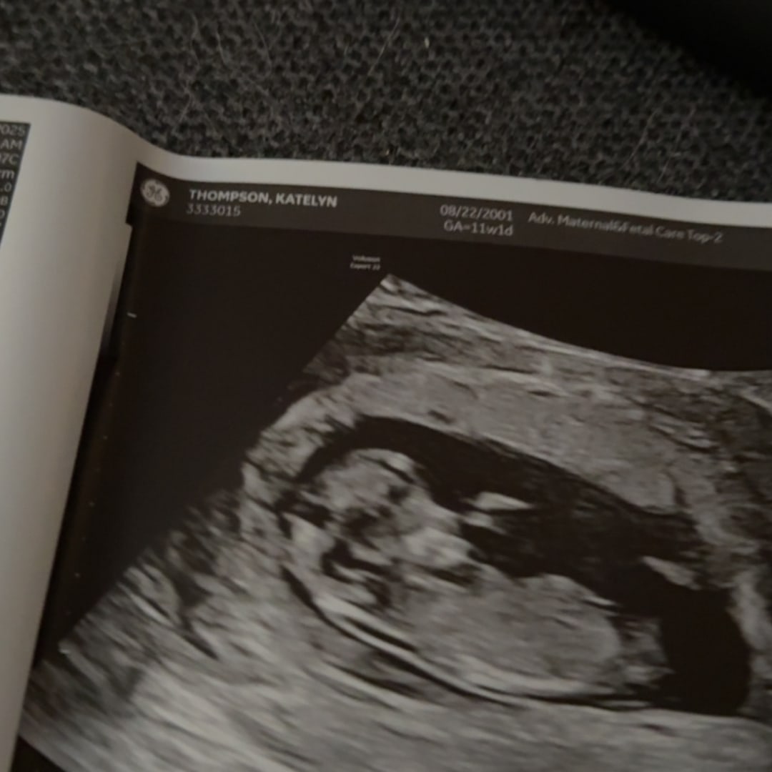 Photo shared by Katelyn for their Babylist baby registry.