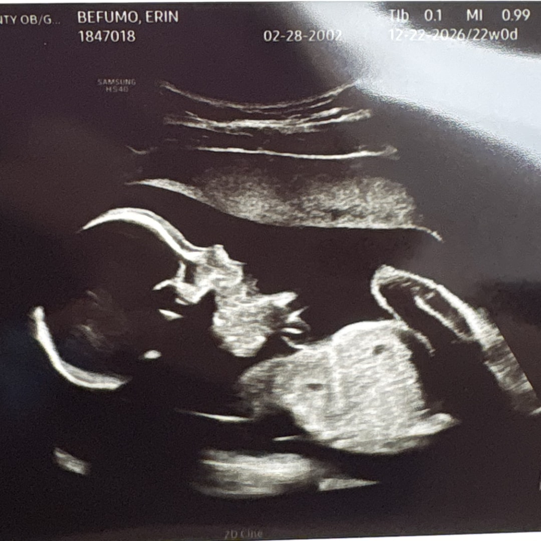 Photo shared by Erin for their Babylist baby registry.