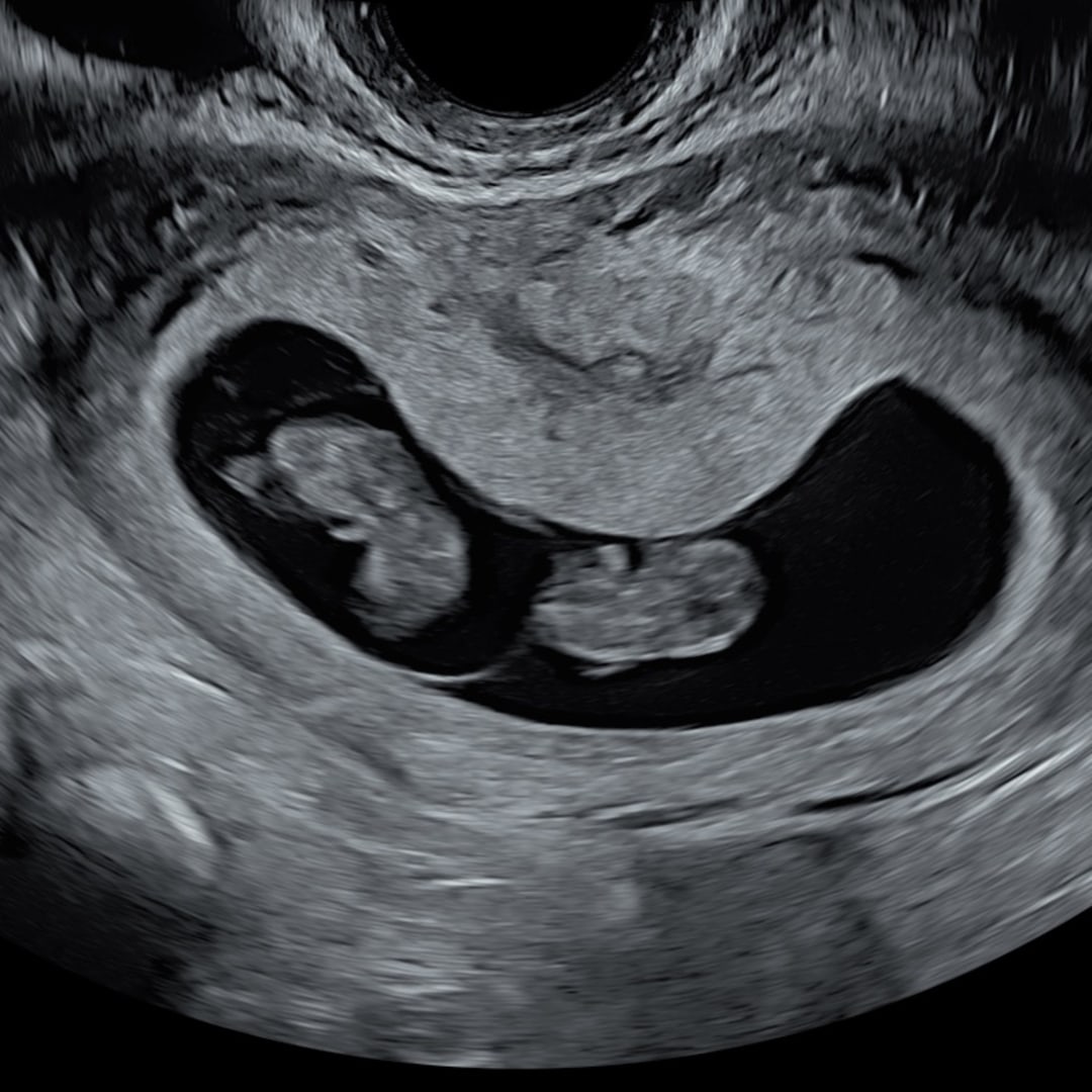 Photo shared by Emily for their Babylist baby registry.