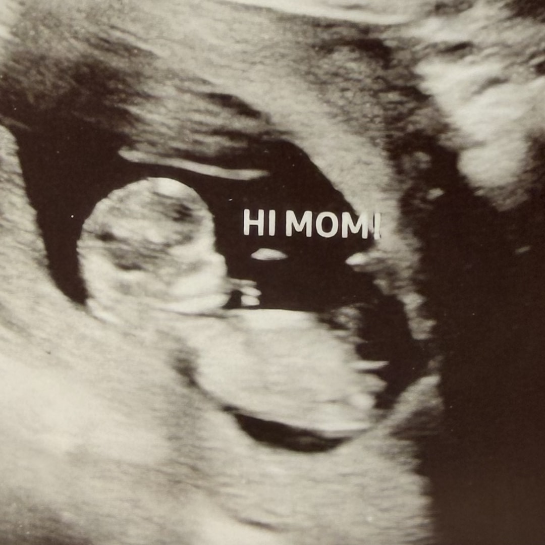Photo shared by Evelyn for their Babylist baby registry.