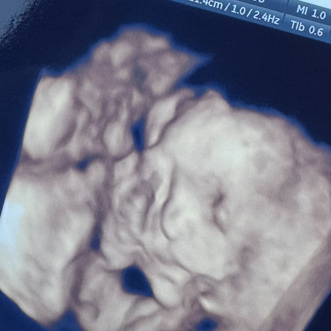 Photo shared by Jayda for their Babylist baby registry.
