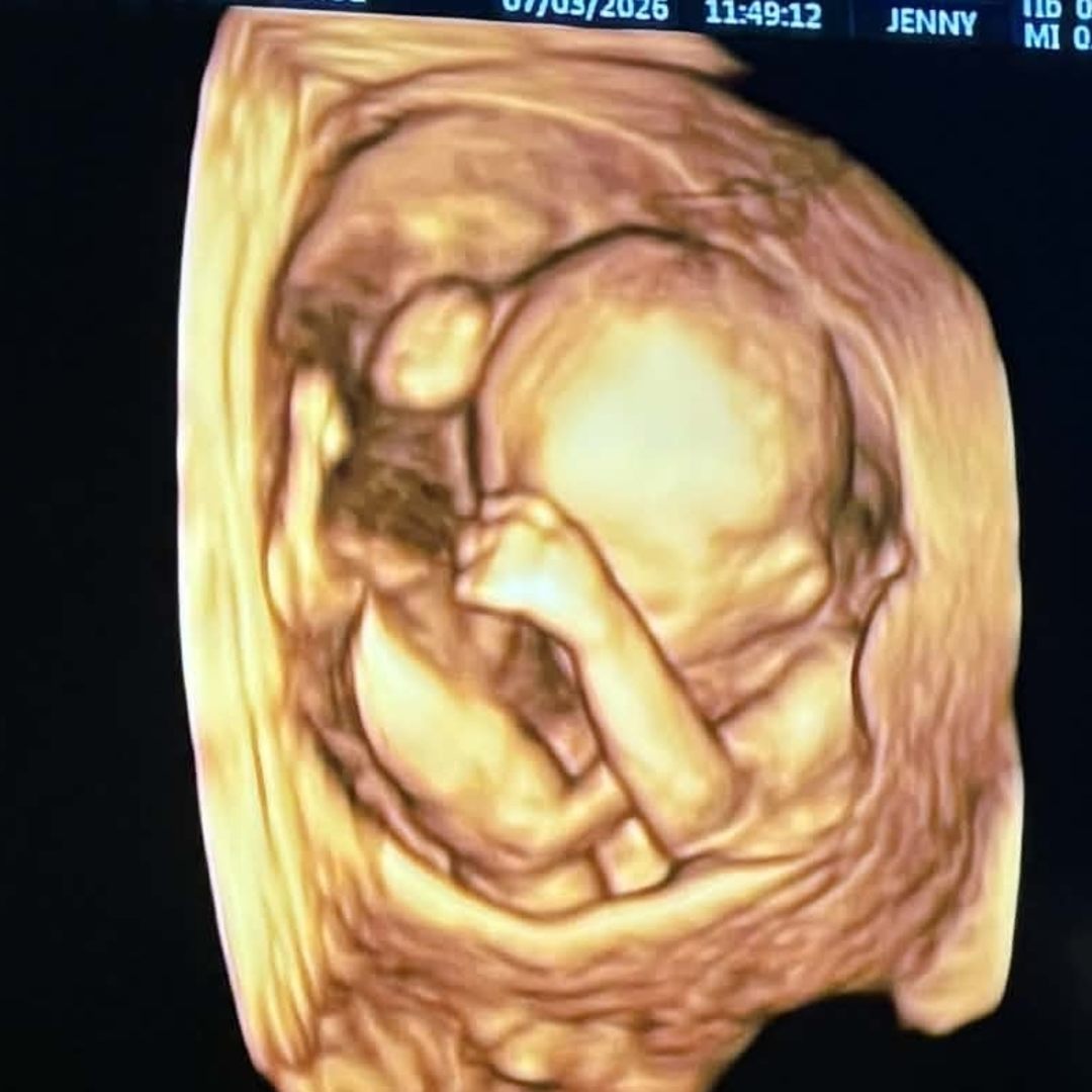 Photo shared by Destiny for their Babylist baby registry.