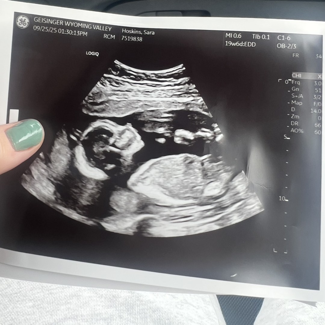 Photo shared by Sara for their Babylist baby registry.