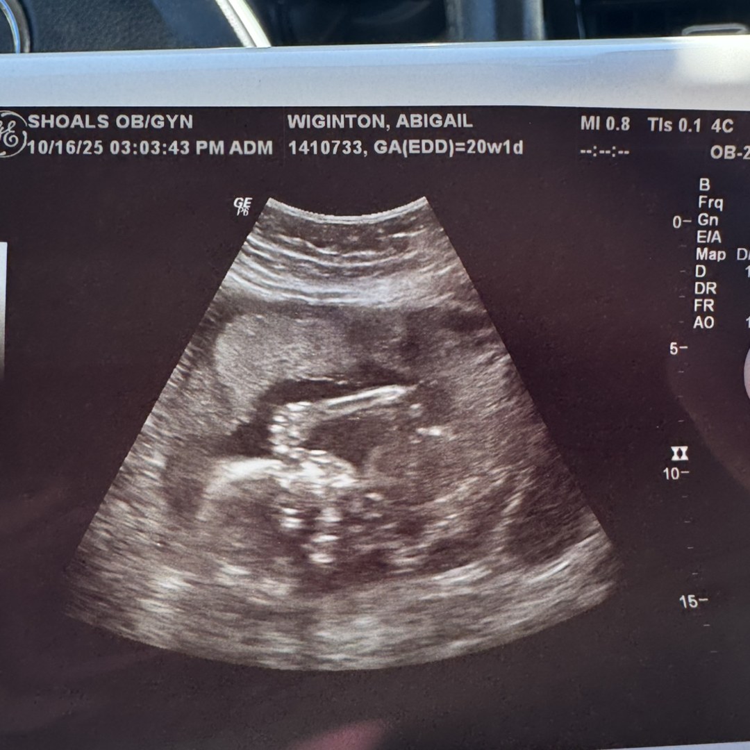 Photo shared by Abbi for their Babylist baby registry.