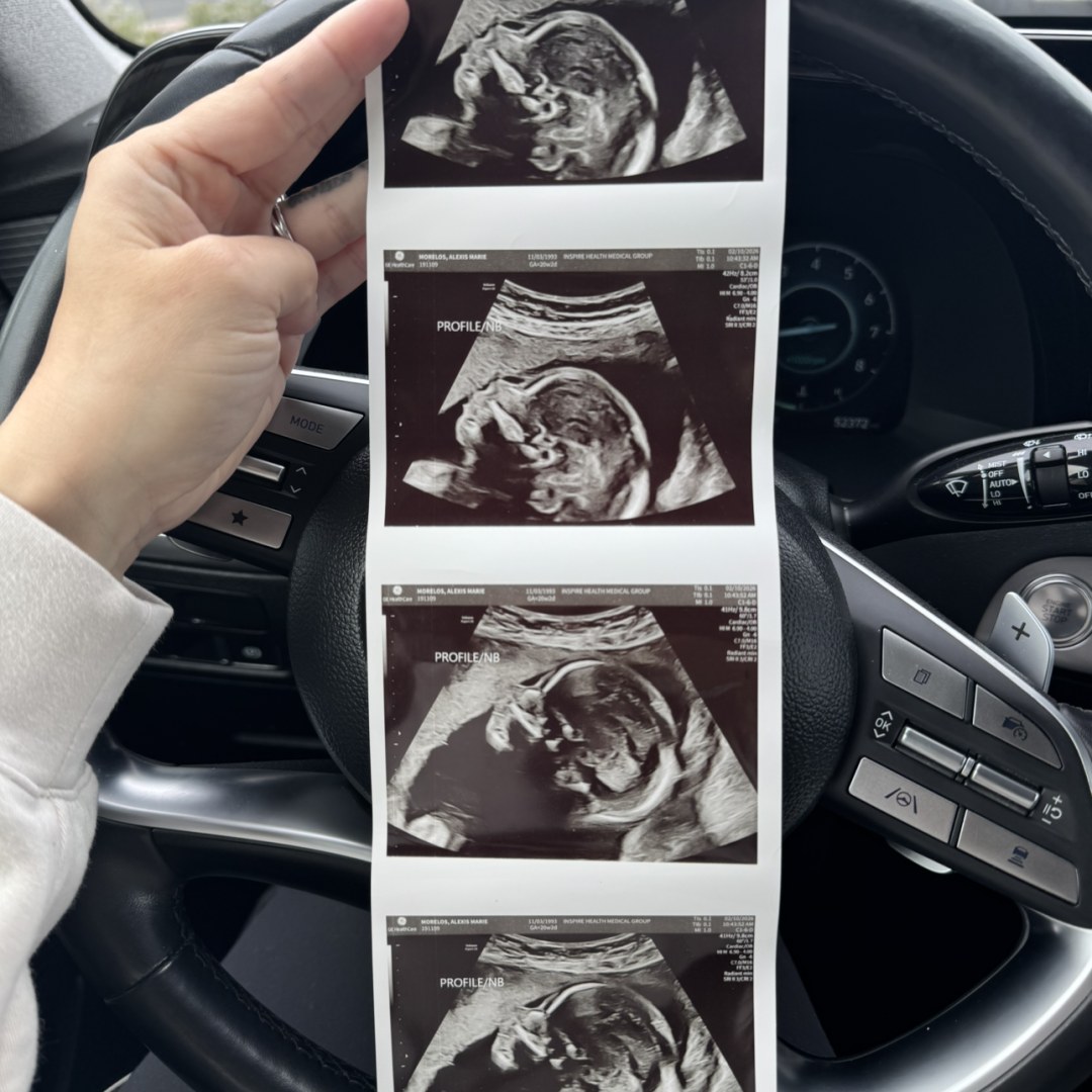 Photo shared by Alexis for their Babylist baby registry.