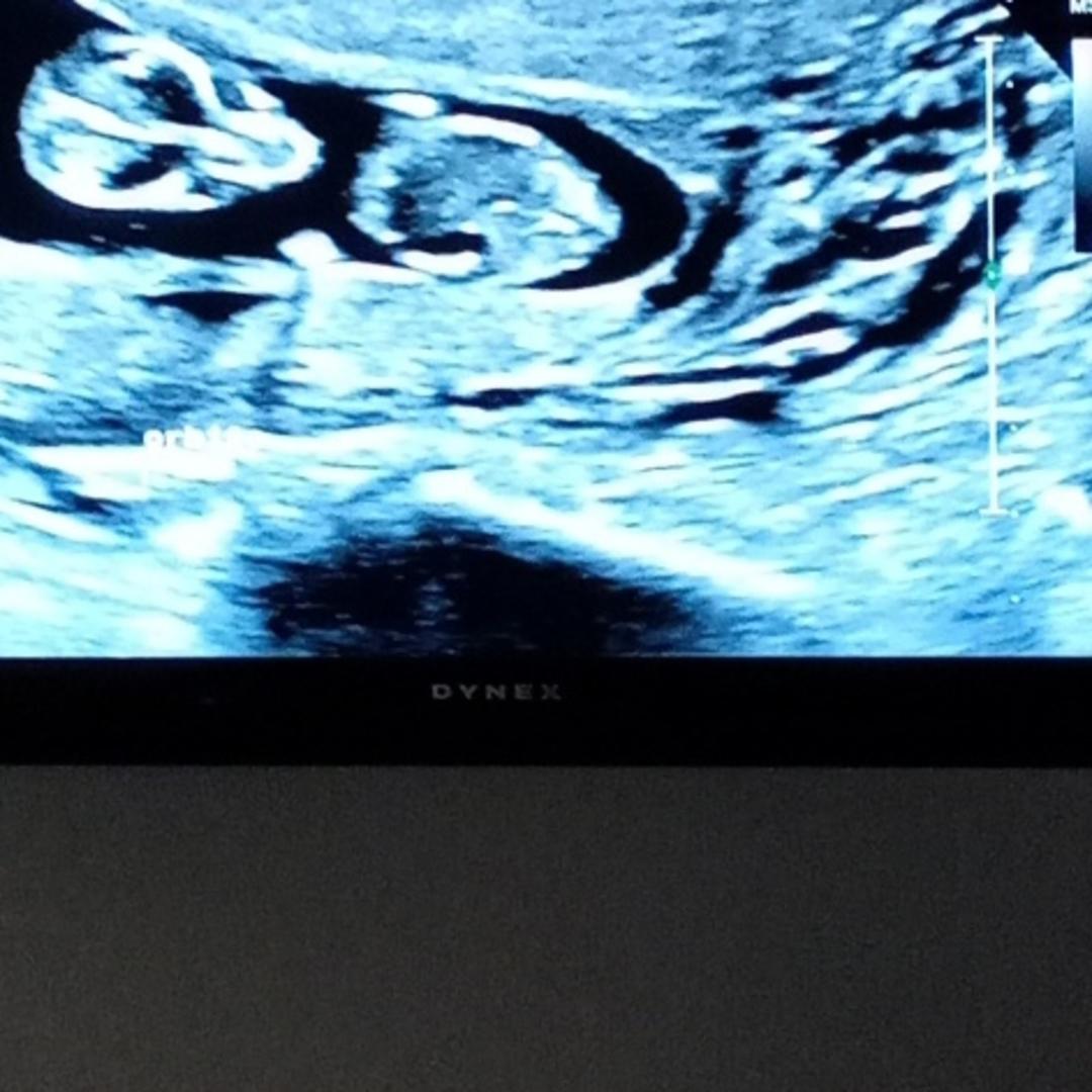 Photo shared by Alexis for their Babylist baby registry.