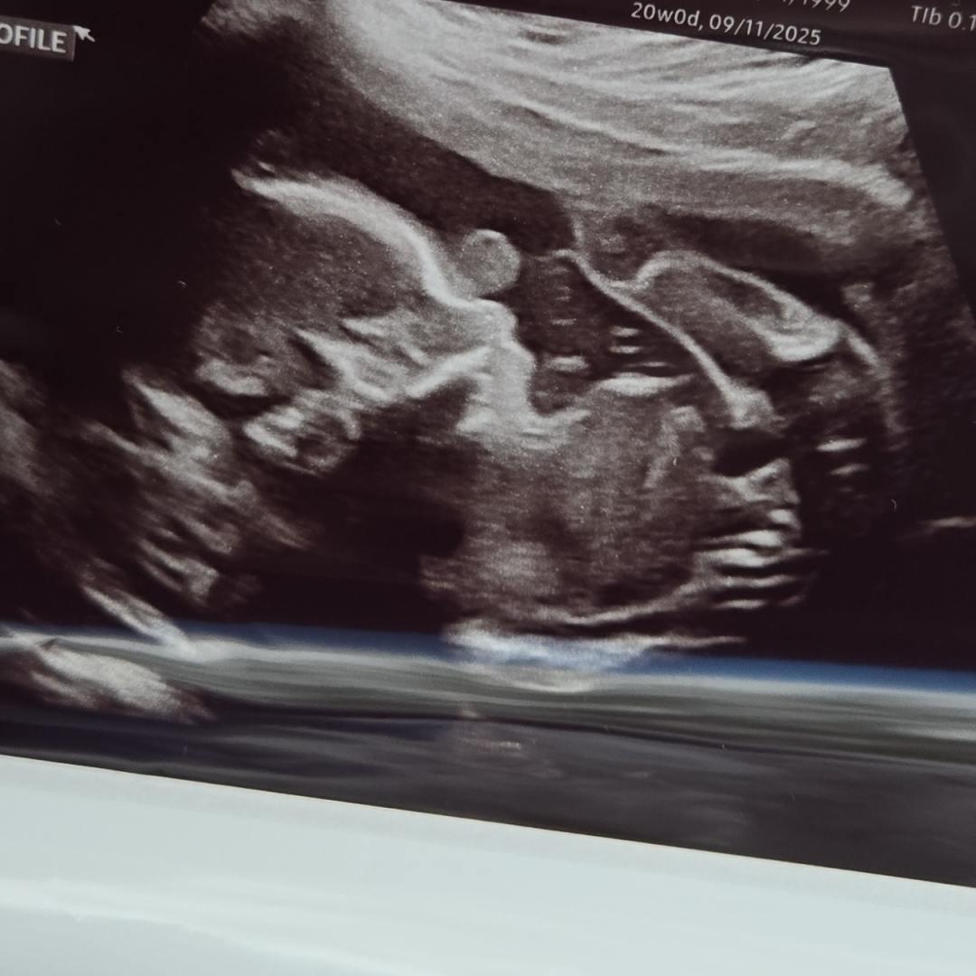 Photo shared by Elise for their Babylist baby registry.