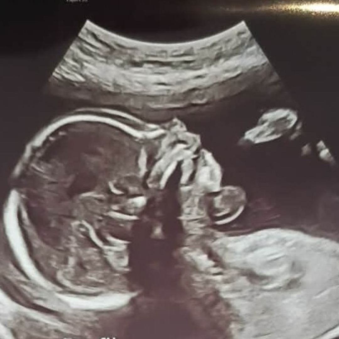 Photo shared by August for their Babylist baby registry.