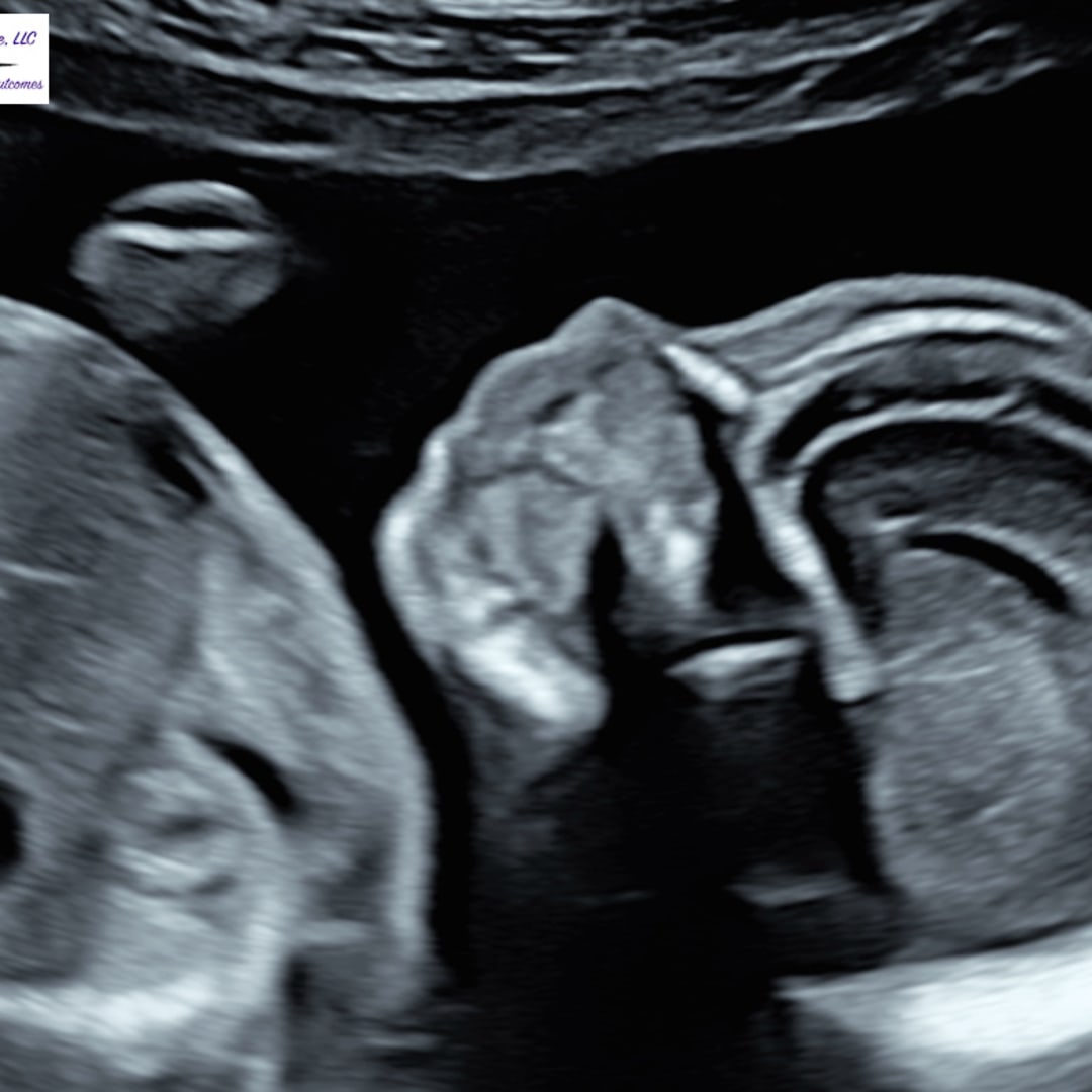 Photo shared by Chloe for their Babylist baby registry.