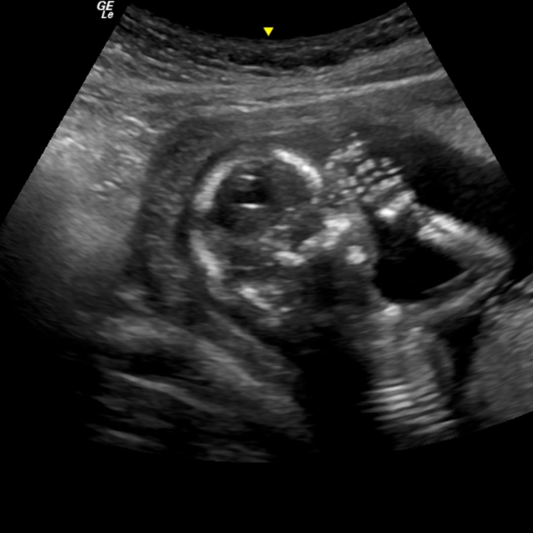 Photo shared by Caitlin for their Babylist baby registry.