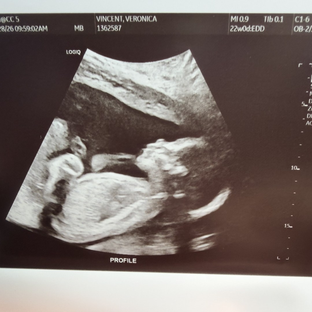 Photo shared by Veronica for their Babylist baby registry.