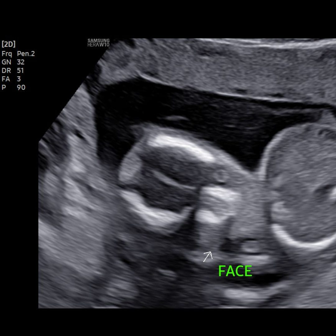 Photo shared by Sherry for their Babylist baby registry.