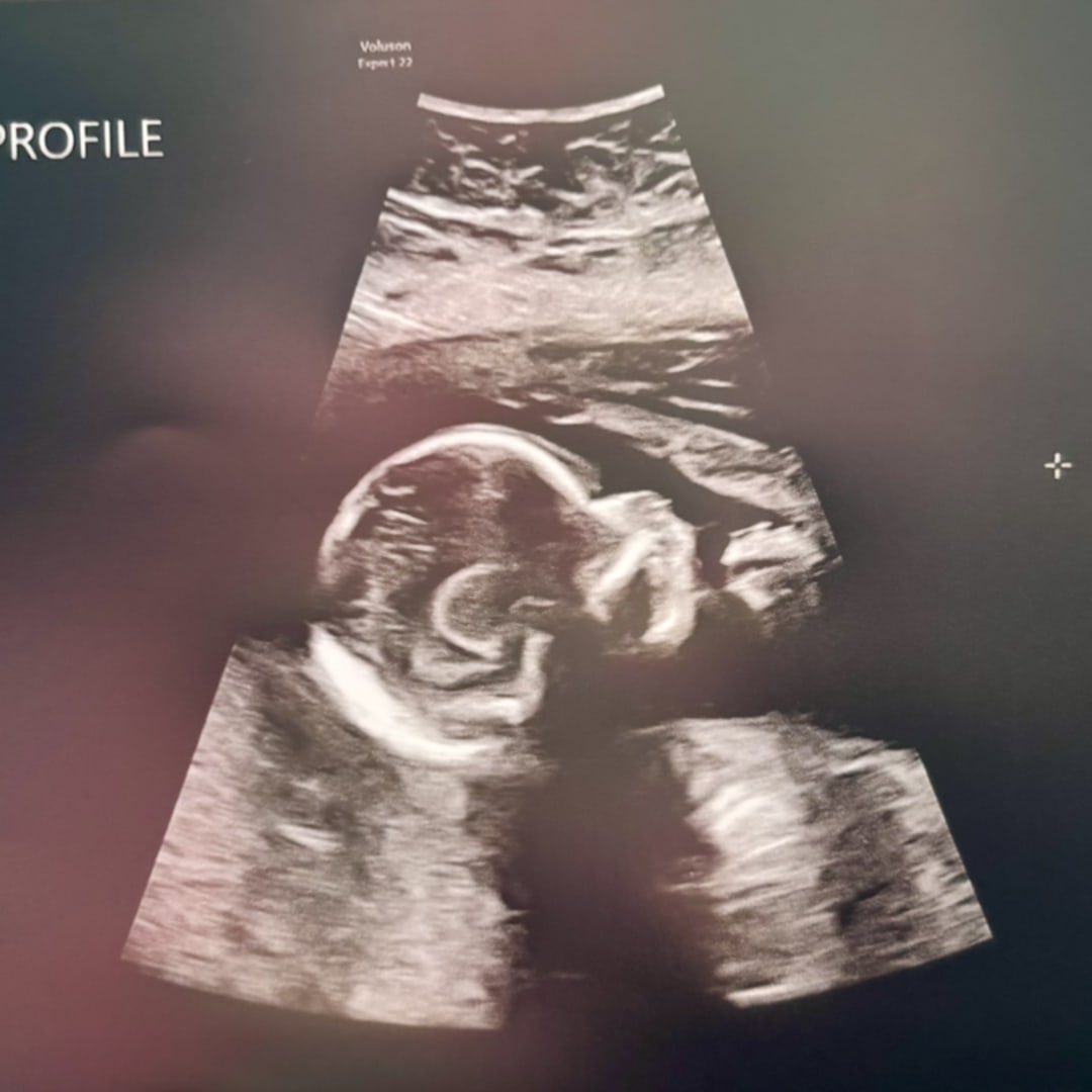 Photo shared by Carol for their Babylist baby registry.