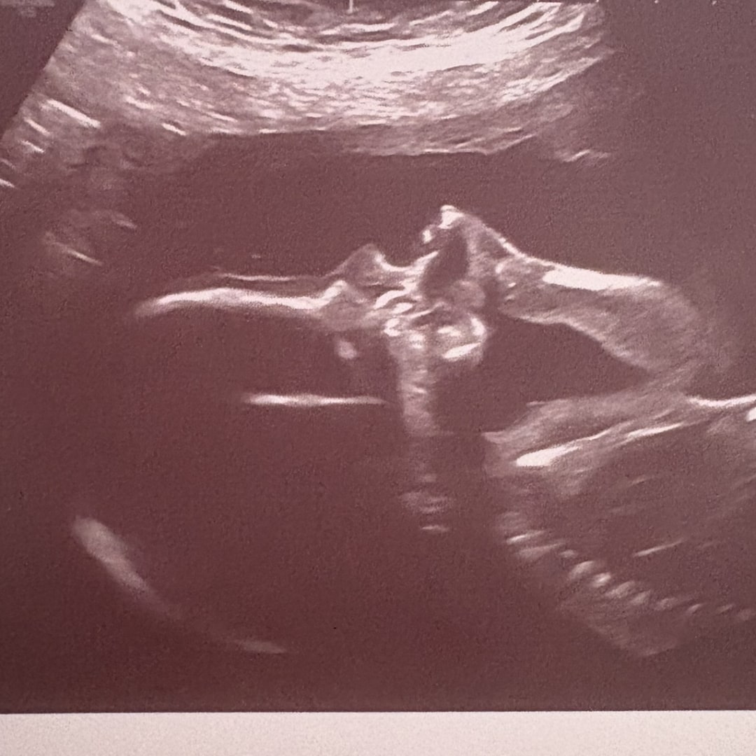 Photo shared by Denise for their Babylist baby registry.