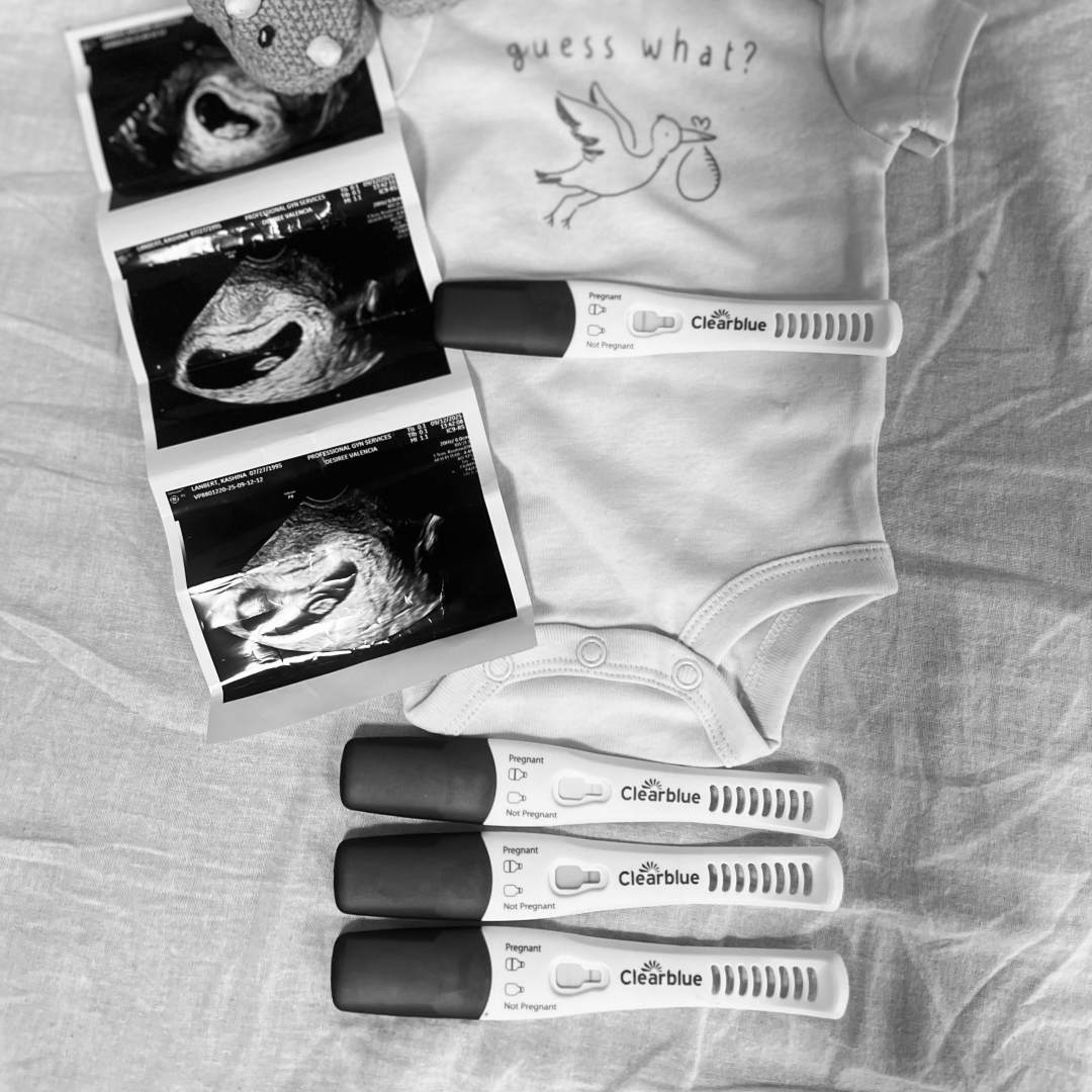 Photo shared by Kashina for their Babylist baby registry.