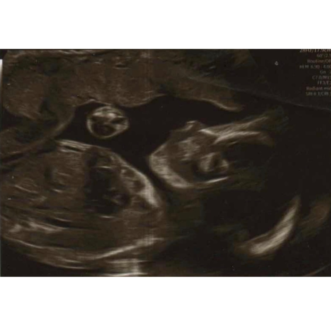 Photo shared by Stephanie for their Babylist baby registry.