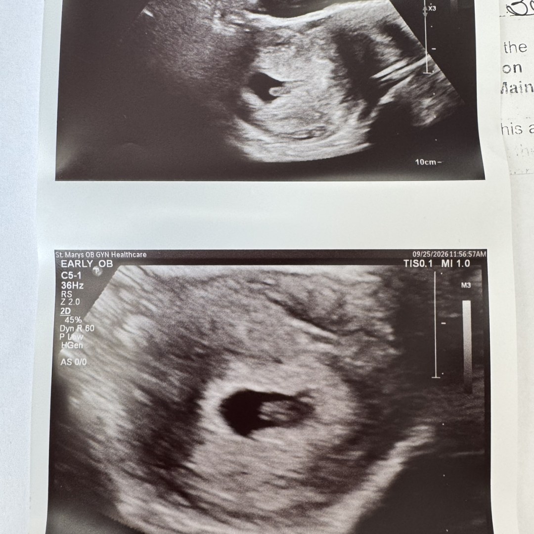 Photo shared by Hiedi for their Babylist baby registry.