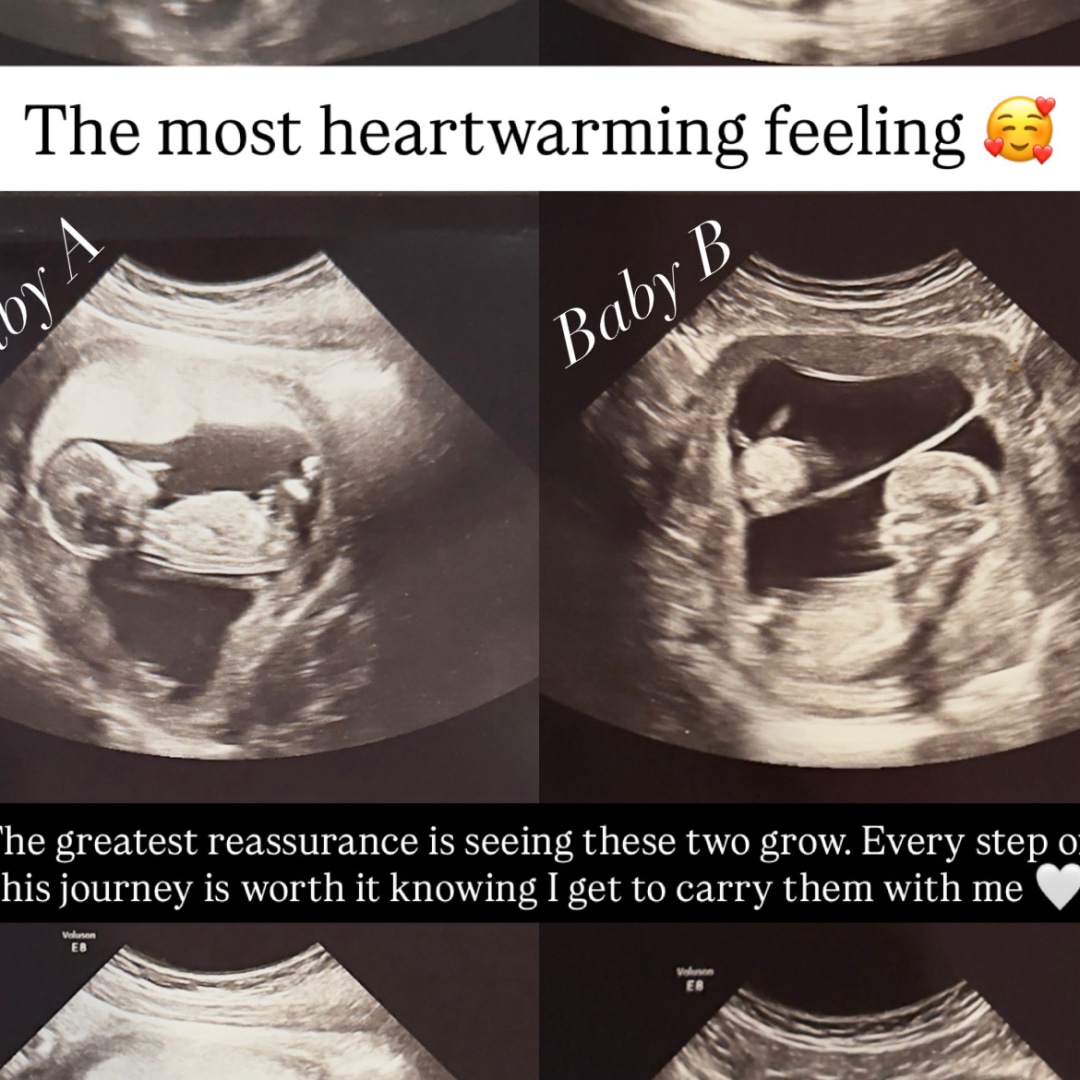 Photo shared by Cassandra for their Babylist baby registry.