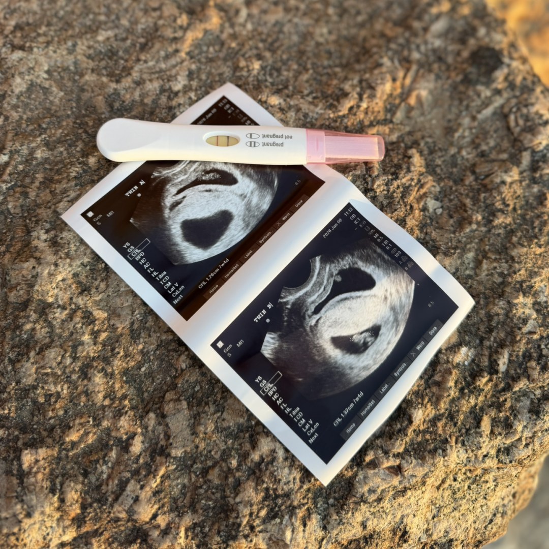 Photo shared by Madisynne for their Babylist baby registry.