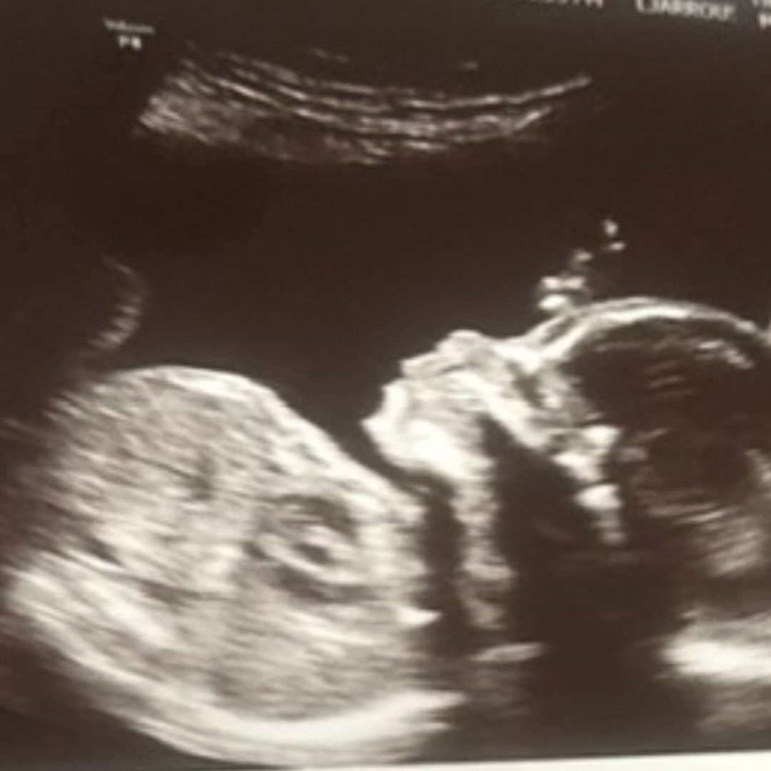 Photo shared by Andrea for their Babylist baby registry.