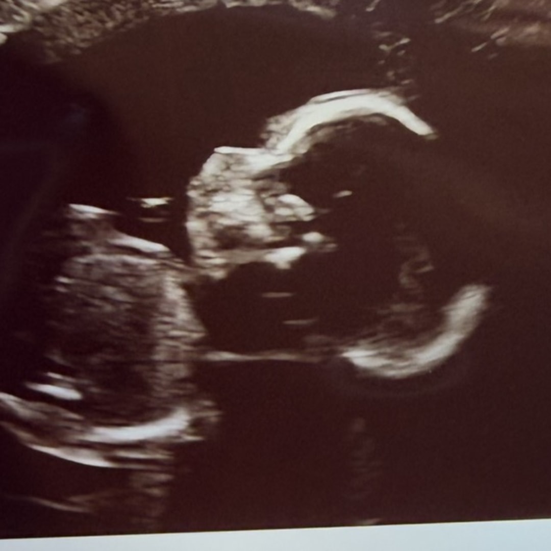 Photo shared by Amanda for their Babylist baby registry.