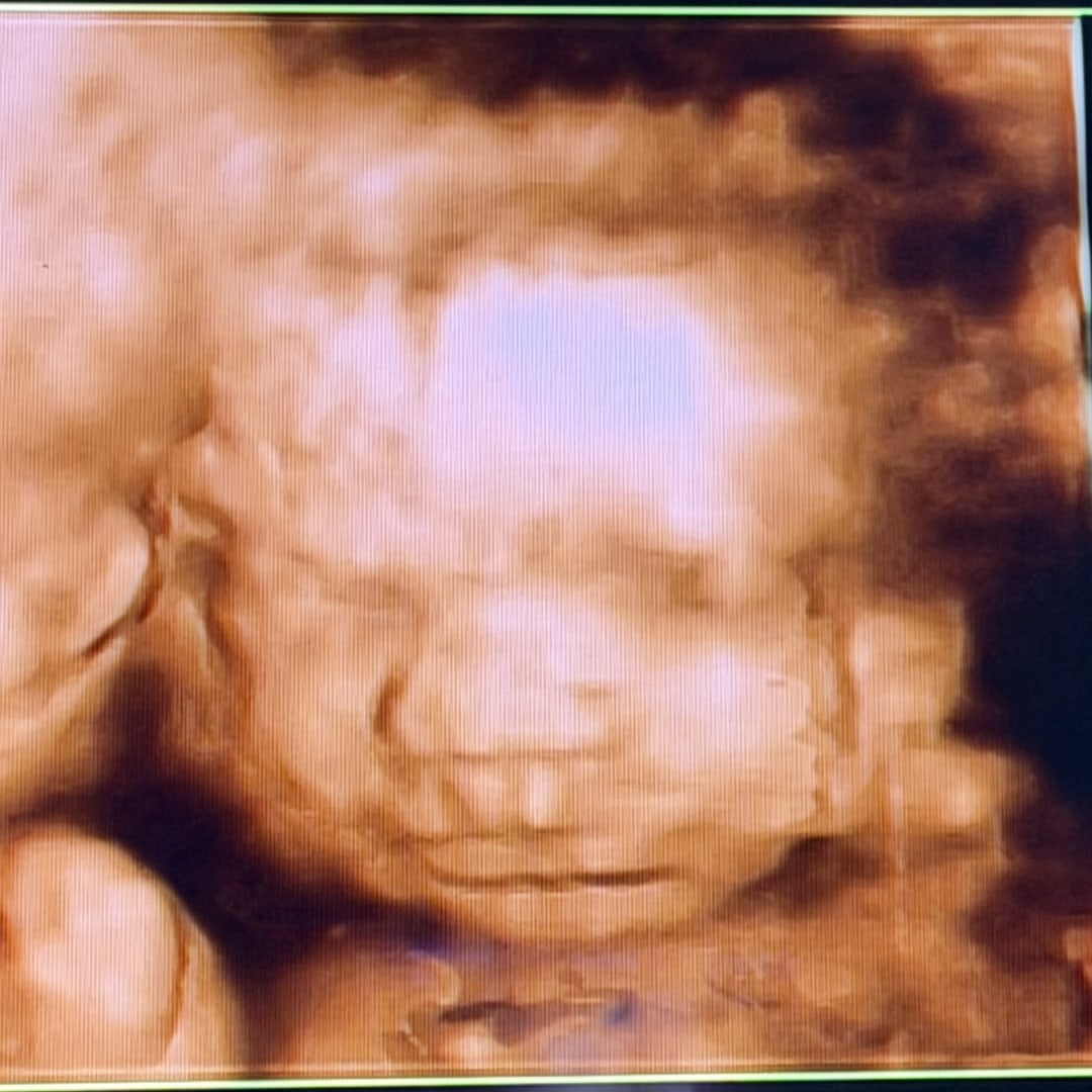 Photo shared by Shelby for their Babylist baby registry.