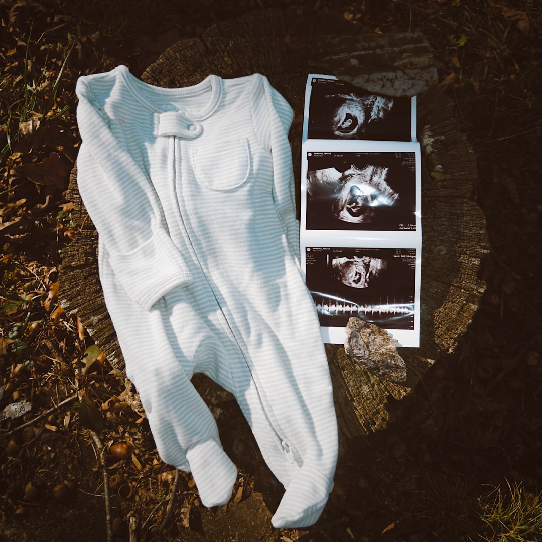 Photo shared by Tristen for their Babylist baby registry.